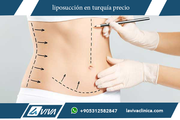 abdominoplastia en turquía