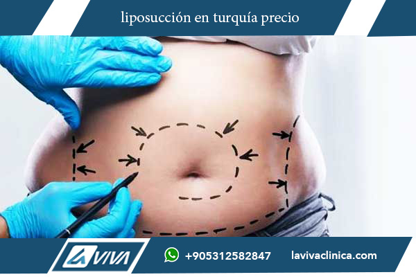 abdominoplastia precio turquía