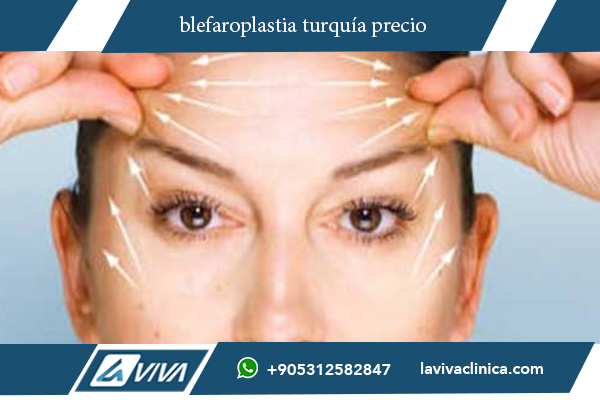 blefaroplastia turquia