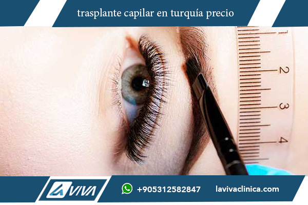 implantes capilares turquia