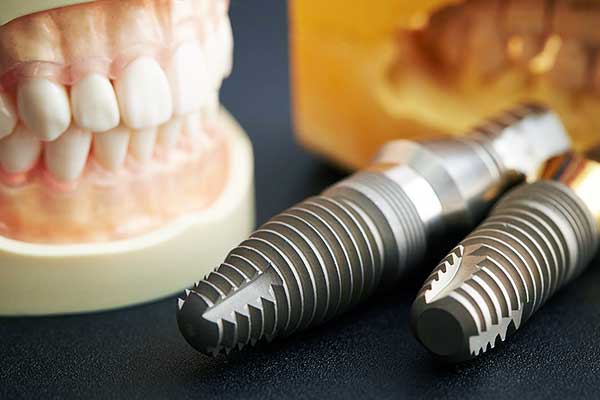 implantes dentales en turquia precios