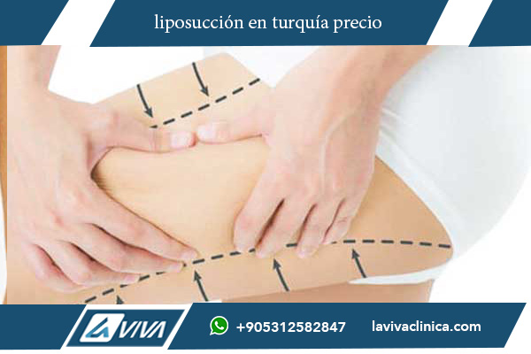 lipoescultura precio turquía