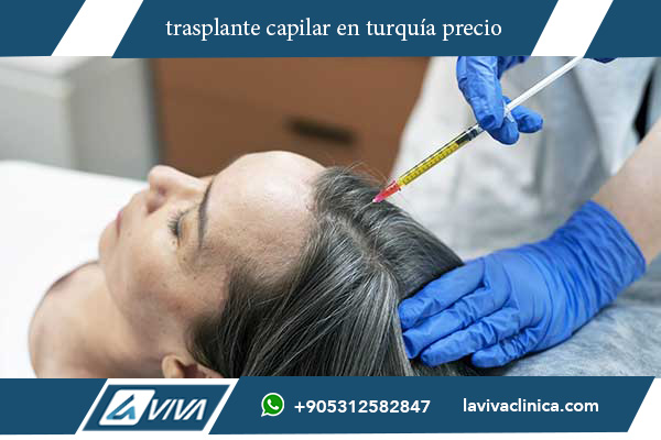 mejor clinica capilar turquia