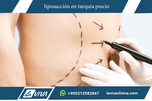 operacion turquia liposuccion