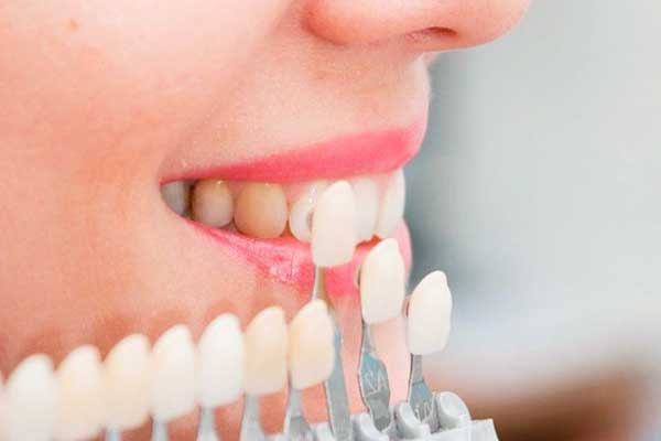 precio de implantes dentales en turquia