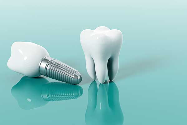 precio implantes dentales para toda boca turquía