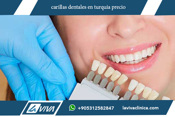 carillas dentales en turquia precio