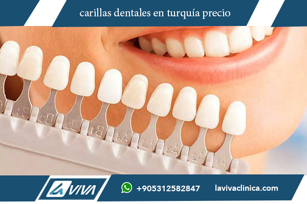 carillas dentales en turquía precio