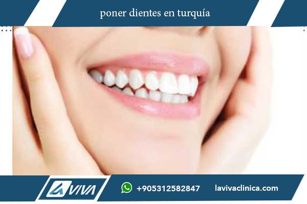 poner dientes en turquía