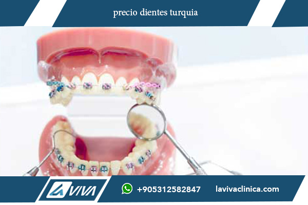 precio dientes turquia