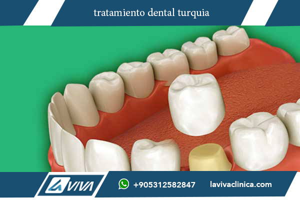 tratamiento dental turquia