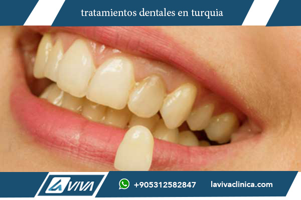 tratamientos dentales en turquia