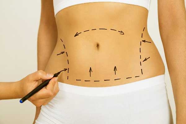 Esculpir el Cuerpo: Tratamientos como la liposucción y la abdominoplastia ofrecen la posibilidad de redefinir y esculpir tu cuerpo, logrando una silueta armoniosa y atractiva.