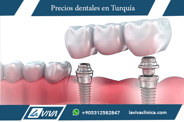 precio zirconio dental, coronas de zirconio precio, costo dientes de zirconio, cuánto cuesta el zirconio dental, tratamiento con zirconio dental costo, coronas dentales materiales comparativa, zirconio dental ventajas, zirconio dental opiniones, zirconio dental en Turquía, experiencia dental zirconio Turquía , zirconio dental, coronas de zirconio, costo zirconio dental, ventajas del zirconio, materiales dentales, estética dental, tratamientos dentales en Turquía, odontología estética , ¿Es caro el zirconio dental?, ¿Qué precio tiene una corona de zirconio?, ¿Vale la pena el zirconio dental?, ¿Cómo se cuidan las coronas de zirconio?, ¿Dónde encontrar coronas de zirconio económicas?, ¿Qué ventajas tiene el zirconio dental?, ¿Cuánto cuesta una corona en Turquía?, ¿Por qué elegir zirconio para coronas dentales?