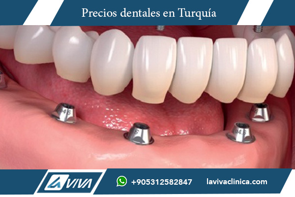 dientes de zirconia costos elevados, por qué la zirconia es tan cara, beneficios de dientes de zirconia, estética dental zirconia, prótesis dentales avanzadas, odontología de alta calidad, comparativa materiales dentales, experiencias con zirconia dental, Istanbul International Aesthetic Center, tratamiento dental premium , dientes de zirconia, costos dentales, estética dental, materiales dentales, odontología avanzada, zirconia dental, salud bucal, experiencias dentales, testimonios pacientes, tratamientos dentales , ¿por qué los dientes de zirconia son caros?, beneficios de la zirconia dental, diferencias entre zirconia y porcelana, cómo encontrar centros dentales, experiencias con dientes de zirconia, ¿vale la pena la zirconia?, alternativas a la zirconia dental, tratamientos dentales en Estambul, comparativa costos dentales, tratamientos dentales premium