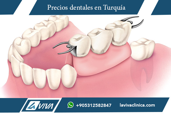 implantes dentales tipos, cuáles son los tipos de implantes dentales, tipos de implantes endoóseos, implantes dentales cigomáticos, implantes subperiósticos ventajas, tratamientos de implantes dentales en Turquía, costos de implantes dentales Turquía, beneficios de implantes endoóseos, casos reales de implantes dentales , implantes dentales, tratamiento dental en Turquía, costo de implantes dentales, guía de implantes dentales, tipos de implantes, recuperación de implantes dentales, clínica dental en Estambul, sonrisa perfecta, cuidado postoperatorio dental, Istanbul International Aesthetic Center , qué tipos de implantes dentales existen, cuál es el mejor tipo de implante dental, qué son los implantes cigomáticos, qué son los implantes subperiósticos, cómo elegir un implante dental adecuado, cuánto cuestan los implantes dentales en Turquía, diferencias entre implantes endoóseos y cigomáticos, experiencias de pacientes con implantes dentales