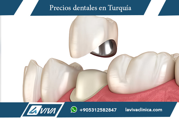 titanio vs zirconio, implantes dentales de titanio, implantes dentales de zirconio, costos de implantes dentales, diferencias entre titanio y zirconio, cuál es más caro titanio o zirconio, estética dental con zirconio, biocompatibilidad de titanio, implantes dentales económicos en Turquía, turismo dental en Turquía, precios de implantes dentales, implantes dentales en México , implantes dentales, titanio, zirconio, implantes dentales Turquía, turismo dental, odontología estética, costos dentales, dentistas internacionales, clínicas dentales , ¿Es más caro el titanio o el zirconio?, ¿Qué material es mejor para implantes dentales?, beneficios del titanio en odontología, ventajas del zirconio en implantes, diferencias entre titanio y zirconio en estética dental, cuánto cuesta un implante dental de zirconio, ¿dónde encontrar implantes dentales baratos?, ¿por qué elegir zirconio sobre titanio?