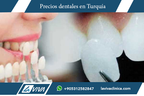 Sonrisa de Hollywood en Alemania , sonrisa de hollywood, precios en turquía y alemania, calidad dental turquía, turismo médico turquía, odontología avanzada turquía, ahorro dental