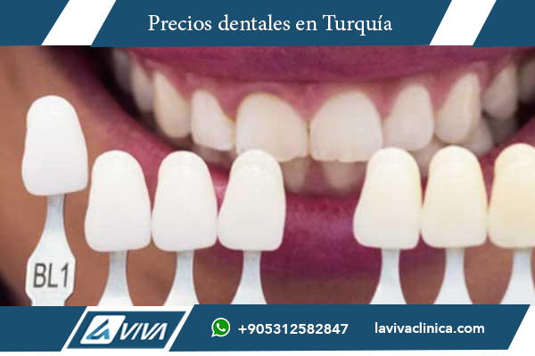 Sonrisa de Hollywood en Polonia , sonrisa de hollywood, estética dental, odontología en Turquía, clínicas dentales Turquía, turismo dental, comparación costos dentales, sonrisa perfecta, carillas dentales, blanqueamiento dental