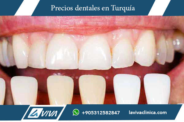 Sonrisa de Hollywood en Serbia , sonrisa de Hollywood Turquía, costos odontológicos Turquía, comparación dental Turquía Serbia, mejor país para estética dental, clínicas dentales Turquía, paquetes todo incluido Turquía, odontología estética