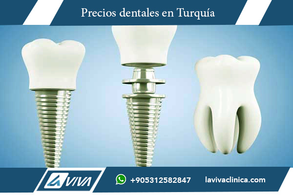 implantes dentales en Bélgica , implantes dentales, precios implantes Bélgica Turquía, turismo dental, dentistas en Turquía, clínicas dentales Turquía, ahorro en implantes dentales, alta calidad odontológica, implantes All-on-4, beneficios de Turquía, odontología avanzada