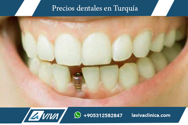 implantes dentales en Dinamarca , implantes dentales Turquía, costos dentales Dinamarca vs Turquía, ahorro en implantes dentales, turismo dental, tratamientos dentales Turquía