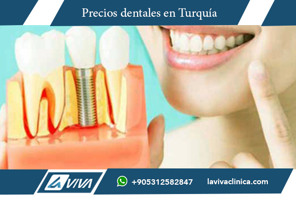 implantes dentales en Reino Unido , implantes dentales, tratamientos dentales Turquía, precios de implantes dentales, turismo médico Turquía, dentistas en Turquía, ahorro dental, implantes All-on-4, injerto óseo, clínicas dentales Turquía