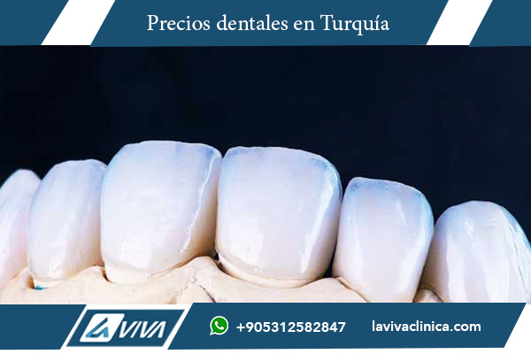 carillas dentales, precios carillas dentales, carillas dentales en Turquía, carillas dentales en Canadá, comparación precios carillas, turismo dental Turquía, costos carillas dentales, ahorro en tratamientos dentales, Laviva Clinic, Dr. Wahid Katkhuda, tratamientos dentales Turquía, estética dental, carillas de porcelana, carillas de composite, sonrisas perfectas, turismo médico, dentistas en Turquía, clínica dental Turquía