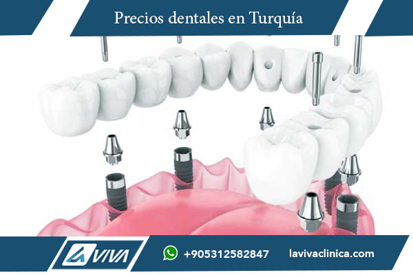 implantes dentales Turquía, implantes dentales Corea del Sur, comparación de precios implantes dentales, turismo dental Turquía, turismo dental Corea del Sur, precios implantes dentales Turquía, precios implantes dentales Corea, mejores implantes dentales, odontología Turquía, clínicas dentales Turquía, odontología Corea del Sur, implantes dentales baratos, calidad implantes Turquía, implantes dentales avanzados, paquetes dentales Turquía, odontología estética Turquía, dentistas Turquía, salud dental internacional