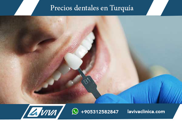 carillas dentales, precios carillas dentales, comparación de precios, carillas dentales Turquía, carillas dentales Países Bajos, carillas de porcelana, carillas de composite, turismo dental, ahorro en tratamientos dentales, Laviva Clinic, Dr. Wahid Katkhuda, estética dental, tratamiento dental en Turquía, costos dentales Europa, carillas dentales baratas, calidad dental Turquía, ventajas de Turquía, odontología estética, turismo médico