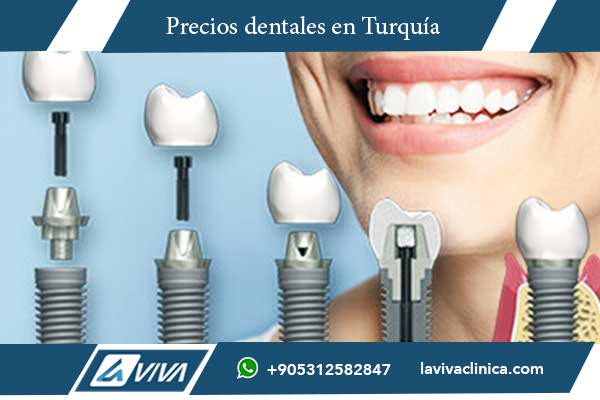 implantes dentales, comparación de precios implantes, implantes dentales Turquía, implantes dentales Argentina, costo implantes dentales, turismo dental Turquía, odontología estética, cirugía dental, All-on-4 Turquía, All-on-6 Turquía, carillas dentales, mejores clínicas dentales Turquía, salud dental, odontología avanzada, implantes baratos, tecnología dental, dentistas en Turquía, clínicas dentales internacionales, turismo médico