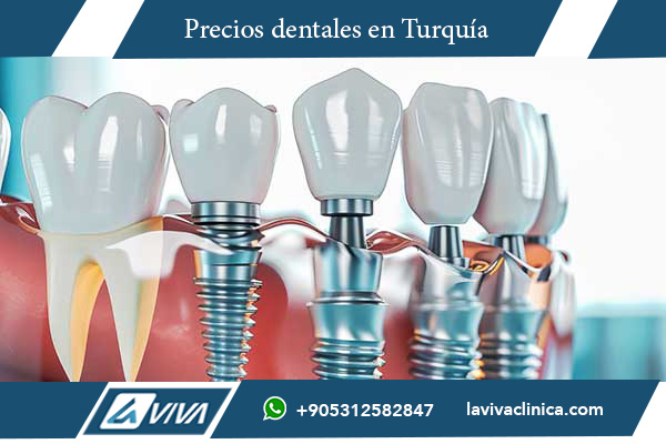 implantes dentales, precios de implantes dentales, Turquía vs. Bulgaria, turismo dental, odontología estética, carillas dentales, clínicas dentales Turquía, tratamientos dentales, salud bucal, dentistas en Turquía, implantología dental, odontología avanzada, costo implantes dentales, mejor país para implantes dentales, odontología en el extranjero, calidad dental Turquía, turismo odontológico, implantes dentales baratos, clínicas dentales en Estambul, Turquía turismo dental