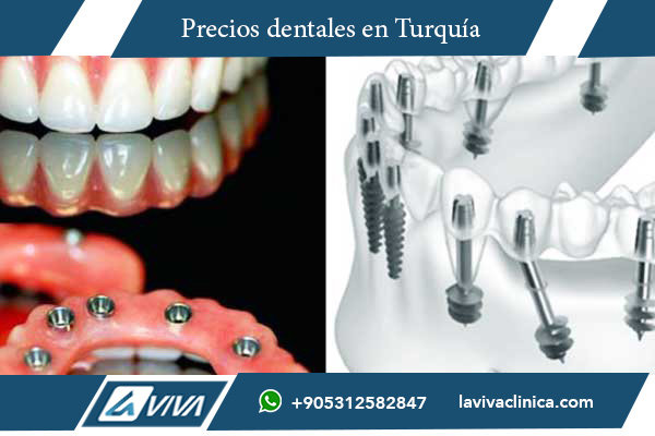 implantes dentales en Turquía, comparación de precios implantes dentales, implantes dentales Noruega, costo de implantes dentales, turismo dental Turquía, implantes dentales baratos, mejor país para implantes dentales, precios implantes Turquía, clínicas dentales en Turquía, ahorro en tratamientos dentales, odontología en Turquía, implantes de titanio Turquía, carillas dentales Turquía, calidad dental en Turquía, cirugía dental en Turquía, dentistas expertos en Turquía, estética dental Turquía, salud dental internacional, turismo médico Turquía, beneficios de implantes en Turquía