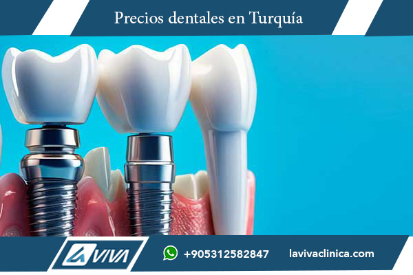 implantes dentales, comparación de precios, Turquía, República Checa, turismo dental, clínicas dentales, salud bucal, odontología estética, implantes baratos, calidad dental, tratamientos dentales, dentistas en Turquía, carillas dentales, implantes de titanio, tecnología dental avanzada, turismo médico, odontología en el extranjero, mejor país para implantes dentales, cirugía oral, recuperación de implantes, ahorro en tratamientos dentales, precios de implantes, clínicas certificadas, mejores dentistas, salud dental internacional