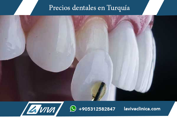 carillas dentales, comparación de precios, Costa Rica, Turquía, turismo dental, odontología estética, precio de carillas, carillas de porcelana, carillas de composite, Laviva Clinic, Dr. Wahid Katkhuda, sonrisa perfecta, tratamiento dental, ahorro dental, calidad dental, dentistas en Turquía, experiencia integral, tecnología dental avanzada