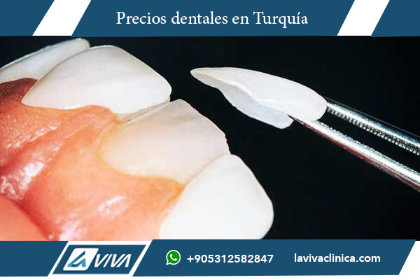 carillas dentales, precios carillas dentales, carillas dentales Turquía, carillas dentales República Checa, comparación de precios, turismo dental Turquía, estética dental, carillas de porcelana, carillas de composite, carillas laminadas, tratamientos dentales, dentistas en Turquía, ahorro en carillas dentales, mejores clínicas dentales, diseño de sonrisa, estética dental Turquía, carillas dentales baratas, carillas dentales calidad, experiencia dental Turquía, turismo médico dental, precios dentales Europa, comparación dental Europa, dentista estético, carillas dentales asequibles, carillas dentales opiniones, elegir Turquía para carillas, carillas dentales costo beneficio