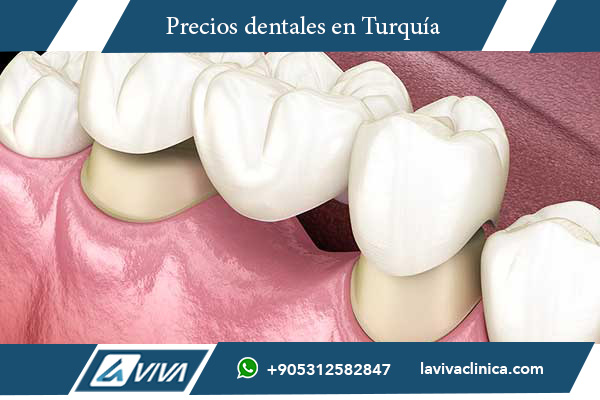 tratamiento dental, implantes dentales, carillas dentales, comparación de precios, turismo dental, Turquía vs Rumanía, odontología estética, dentistas en Turquía, dentistas en Rumanía, salud bucal, costos dentales, clínicas dentales, odontología avanzada, diseño de sonrisa, precios de implantes, carillas de porcelana, odontología digital, cirugía dental, salud y estética dental