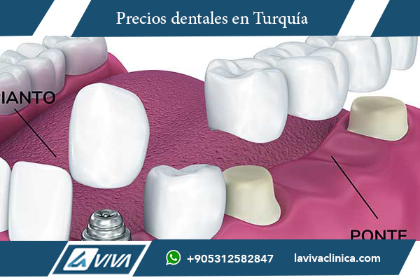 implantes dentales Turquía, implantes dentales Bulgaria, comparación de precios dentales, turismo dental Turquía, turismo dental Bulgaria, tratamiento dental barato, carillas dentales Turquía, coronas dentales Bulgaria, implantes de zirconio Turquía, odontología estética Turquía, clínica dental Turquía, mejores dentistas Turquía, odontología avanzada Turquía, odontología cosmética Bulgaria, salud dental internacional, ahorro en implantes dentales, odontología digital Turquía, materiales dentales de calidad, paquetes dentales todo incluido, dentistas certificados Turquía