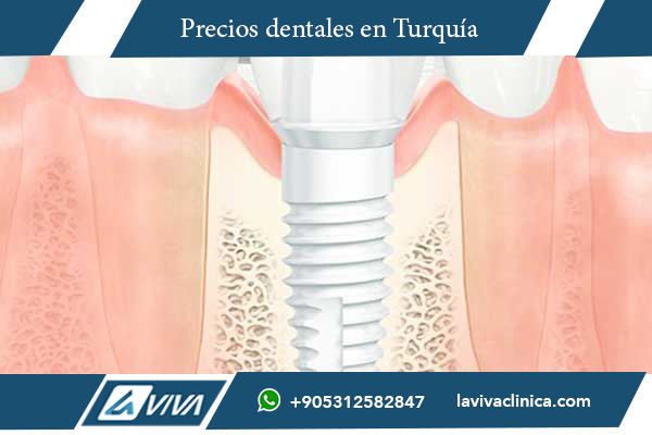 turismo dental, tratamiento dental en Turquía, comparación de precios dentales, implantes dentales Turquía, carillas dentales Turquía, ortodoncia en Turquía, clínica dental Turquía, precio implantes dentales, odontología estética Turquía, dentistas en Turquía, blanqueamiento dental Turquía, odontología en Turquía, Turquía vs Croacia, precios dentales Croacia, mejor destino dental, calidad dental Turquía, salud dental, clínicas dentales Turquía, viaje dental Turquía, atención dental internacional