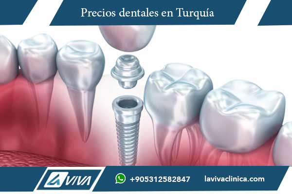 turismo dental, implantes dentales Turquía, comparación dental Turquía Eslovaquia, precios tratamientos dentales, clínicas dentales Turquía, odontología estética, carillas dentales, blanqueamiento dental, salud bucal, tratamientos dentales económicos, odontólogos certificados, costos dentales Turquía, ahorro en tratamientos dentales, tecnología dental avanzada, turismo médico, coronas de zirconio, ortodoncia en Turquía, turismo dental en Europa, atención dental de calidad, odontología en Turquía