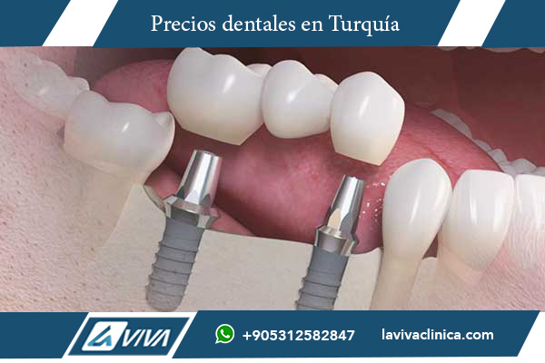 tratamiento dental en Turquía, comparación precios dentales Malta Turquía, turismo dental en Turquía, implantes dentales Turquía, carillas dentales Turquía, blanqueamiento dental Turquía, clínicas dentales Turquía, precios odontología Turquía, odontología estética Turquía, turismo médico Turquía, ahorro en tratamientos dentales, mejores dentistas Turquía, Turquía vs Malta odontología, paquetes dentales todo incluido Turquía, experiencia dental Turquía, clínicas dentales de alta calidad Turquía, odontología avanzada Turquía, implantes dentales económicos, salud dental internacional, atención dental en Turquía