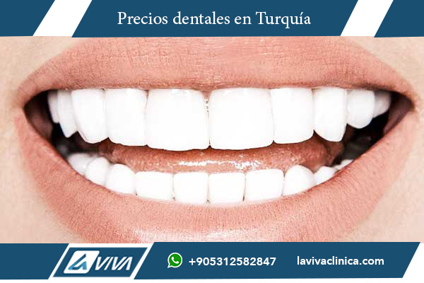 Comparación de precios carillas dentales, carillas dentales Turquía, carillas dentales Ucrania, precios carillas dentales, carillas porcelana Turquía, carillas composite Turquía, Lumineers Turquía, turismo dental Turquía, mejores clínicas dentales Turquía, Laviva Clinic, Dr. Wahid Katkhuda, ahorro en carillas dentales, estética dental Turquía, carillas dentales económicas, calidad dental Turquía, odontología estética, carillas dentales Europa, turismo dental Estambul, experiencia dental Turquía