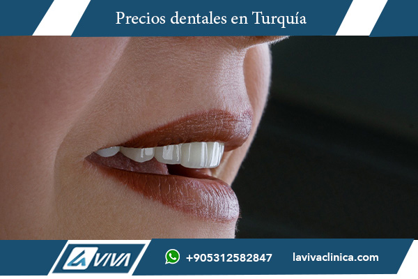 estética dental, precios dentales Turquía, implantes dentales Turquía, carillas dentales Turquía, comparación Italia Turquía, turismo dental, odontología Turquía, clínicas dentales Turquía