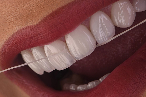 Carillas Dentales en Turquía