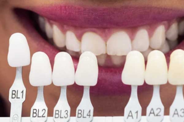 Estética Dentária na Turquia